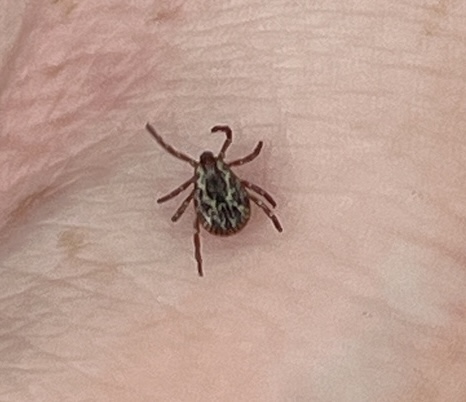 An American dog tick on a persons arm